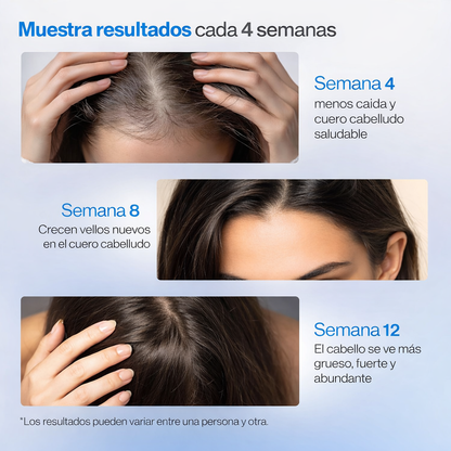 Bodywise™ - Serum anticaída Roll-on